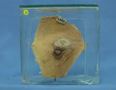 包含`A5;?ˊ広*??L#I鍮芖U瘡塁钋的词条